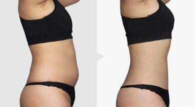 西安華仁醫(yī)院怎樣通過馬世理改臉型技術(shù)，成功改善面部輪廓？