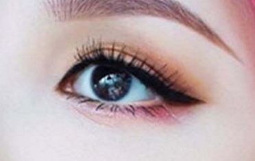 上海九院張余光脂肪室復位手術有多好？眼部整形技術要多受歡迎？