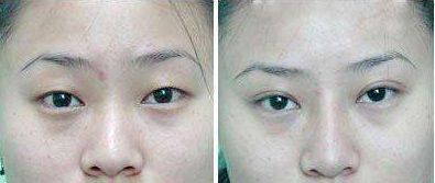 武警廣西總隊(duì)醫(yī)院怎么樣？武警廣西總隊(duì)醫(yī)院簡(jiǎn)介|醫(yī)生團(tuán)隊(duì)|口碑評(píng)價(jià)！