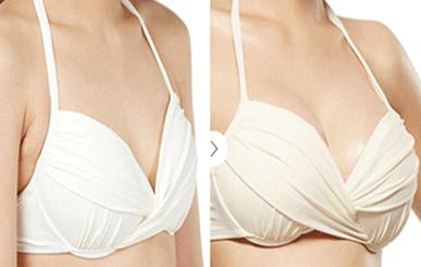 2023深圳溶脂去口周紋醫(yī)生TOP10口碑排行(寧文、王嬌、萬蕓資質(zhì)和口碑在線)