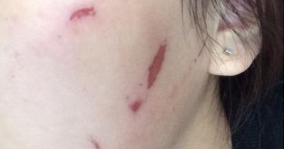 石家莊雅芳亞醫(yī)療美容醫(yī)院的醫(yī)院簡介及醫(yī)生資料是什么？