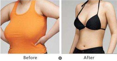 深圳雙眼皮修復(fù)哪家好？機(jī)構(gòu)排名及評(píng)價(jià)調(diào)查報(bào)告