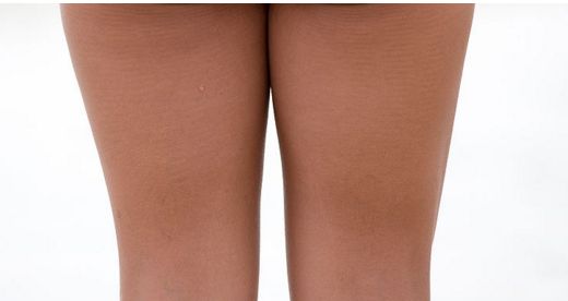 成都哪家醫(yī)院做眼袋好，治療眼袋效果明顯的醫(yī)院有哪些