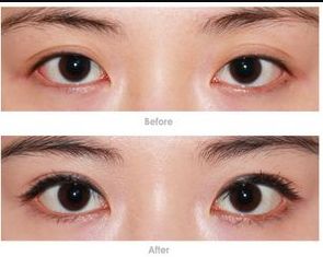 鄭州整容醫(yī)院哪家好？教你如何選擇適合自己的整容醫(yī)院