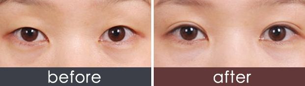 西安哪家美容醫(yī)院口碑好，專業(yè)評(píng)測(cè)推薦？