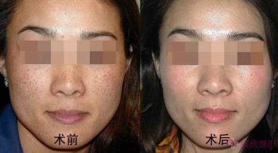 2023青島維蘭除皺專家在榜清單前十位(張雪萍、張偉、王文戈去了都說好！)