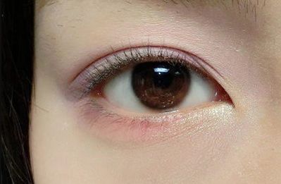 王世虎拉皮和脂肪填充的效果如何？有哪些多樣化的項目值得選擇？技術是否可靠可證？