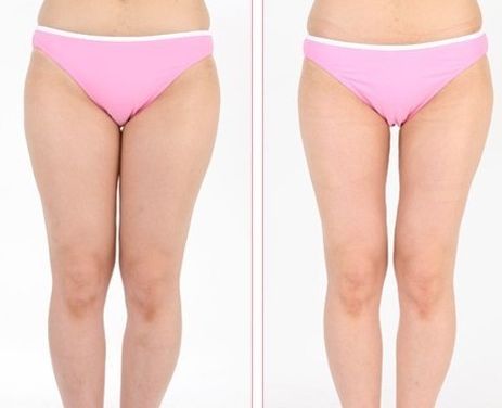 杭州激光去斑好的醫(yī)院排名推薦