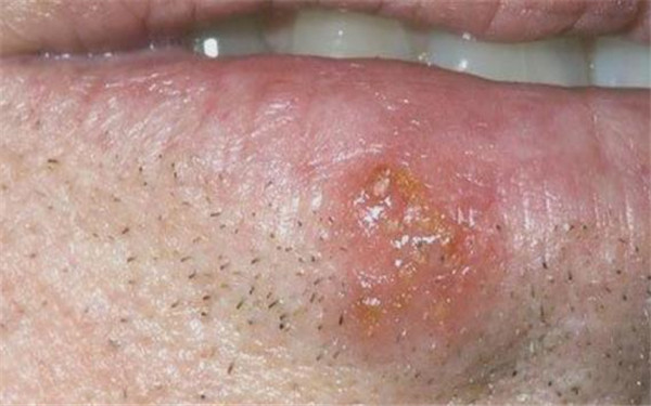 2023新疆水光針祛除唇紋醫(yī)生排行榜前十強(qiáng)(張傳功、李朝陽(yáng)、張偉詳細(xì)資料)