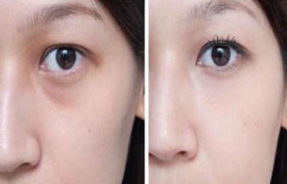 上海整形私密醫(yī)院排名及口碑，哪家好？