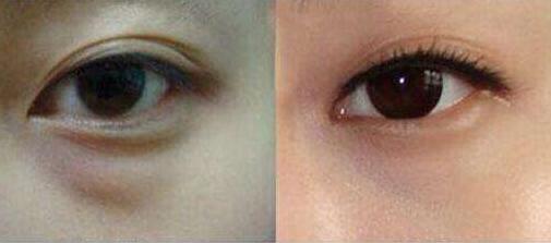 上海更受推薦的隆胸專家排行榜！王濤、江華等5位魅力無(wú)限，非?？孔V！