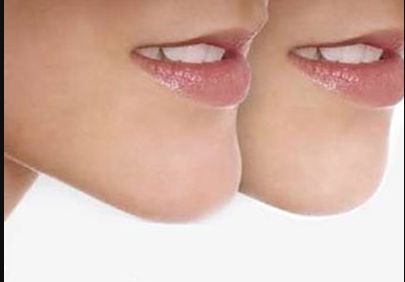 上海除疤痕哪家醫(yī)院好？選擇這家專業(yè)醫(yī)院，讓你告別疤痕煩惱！