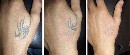 商丘市整容醫(yī)院哪家好？綜合評(píng)價(jià)一覽，找到適合您的理想之選！