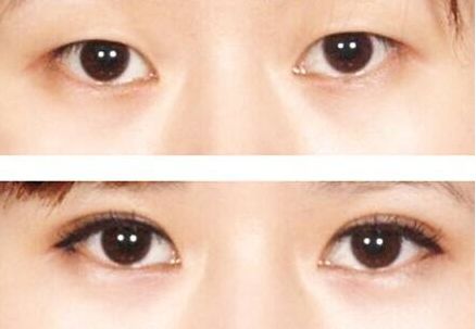 榆林市美容哪家醫(yī)院好？榆林市頂級(jí)美容醫(yī)院推薦