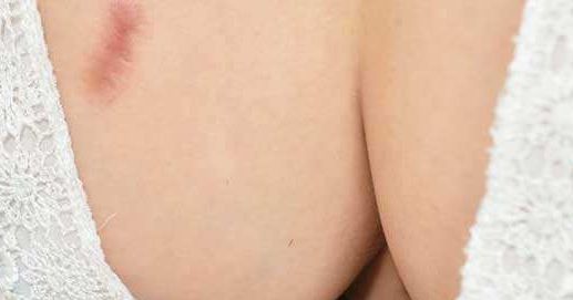 山東小陰唇手術哪家正規(guī)專業(yè)值得選擇？