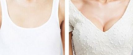 上海抽脂整形醫(yī)院排名2023：哪家好且性價比更高？