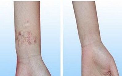 濟(jì)寧去雀斑醫(yī)院哪家好？揭秘濟(jì)寧市治療雀斑效果最好的醫(yī)院