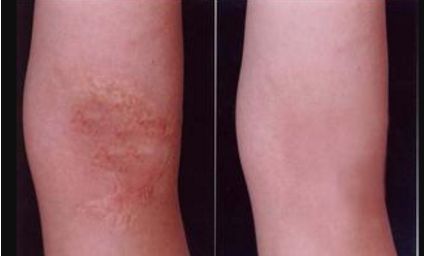 河北雙眼皮手術(shù)哪家好？挑選專業(yè)技術(shù)與良好口碑并存的醫(yī)療機(jī)構(gòu)！