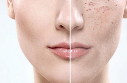 福建泉州海峽醫(yī)療美容醫(yī)院怎么樣？福建泉州海峽醫(yī)療美容醫(yī)院簡介|醫(yī)生團(tuán)隊(duì)|口碑評價(jià)！