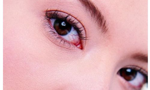 德陽妊娠紋修復(fù)領(lǐng)先機(jī)構(gòu)排名榜單解惑