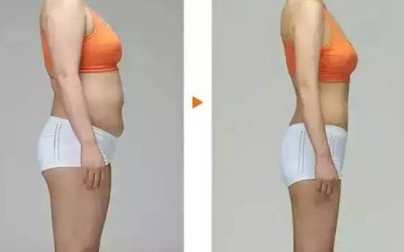 深圳哪家醫(yī)院能夠優(yōu)質(zhì)完成正頜手術(shù)？