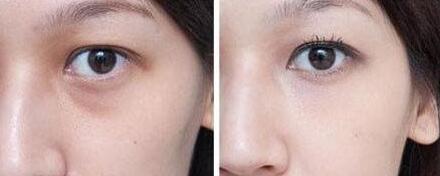 同濟吳毅平醫(yī)生：擅長面部年輕化，口碑怎么樣？同濟吳毅平醫(yī)生，技術(shù)高超面部年輕化效果顯著