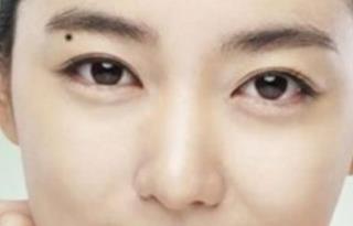 認識眼部大咖，探索秦宏偉醫(yī)生的簡介及雙眼皮案例分享