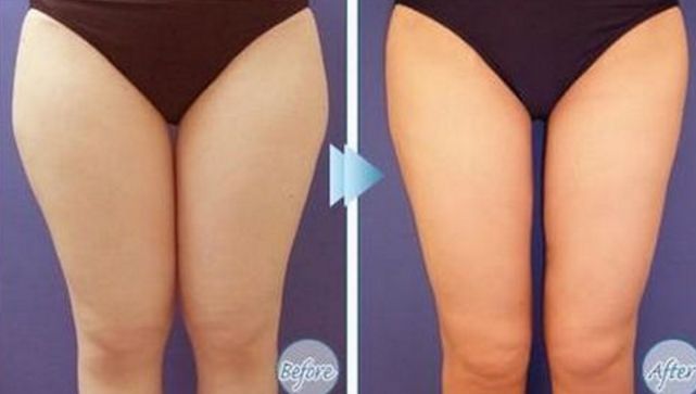 大連專業(yè)祛斑哪家醫(yī)院好？祛斑效果最好的醫(yī)院有哪些？