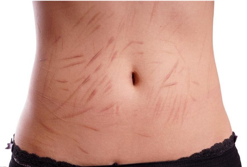 南京抽脂手術(shù)那家醫(yī)院技術(shù)靠譜？哪家醫(yī)院的抽脂效果好？