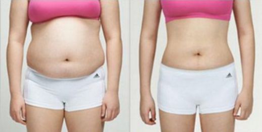 南昌哪家醫(yī)院的吸脂效果好？