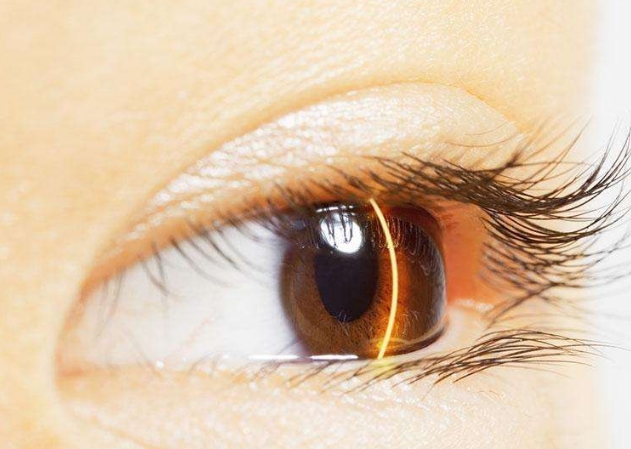 2023蕪湖小切口去額頭紋口碑排名top10強(qiáng)醫(yī)生(曹閃妹、劉傳、謝紀(jì)輝前三打頭陣！)