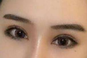 貴陽梁安裕醫(yī)生技術(shù)在線解析腹壁成型效果，怎么樣？