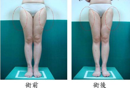 昆明哪家治痘痘好的醫(yī)院，痘痘問題如何有效解決？