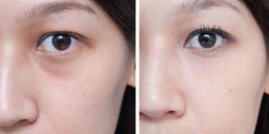 武漢看胎記醫(yī)院哪家好？綜合醫(yī)療機構排行榜詳細解讀