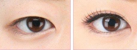 上海哪家醫(yī)院做處女膜修復(fù)好？