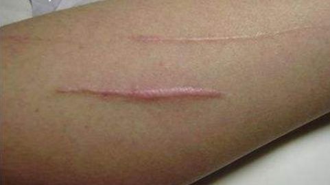 上海韓嘯醫(yī)療美容醫(yī)院的豐胸技術(shù)靠譜嗎？