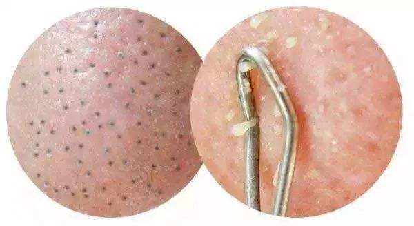 2023蕪湖韓式唯美無痕隆胸排行榜前10強(qiáng)專家(曹晗、杜姜、張輝都是值得信賴的醫(yī)生)