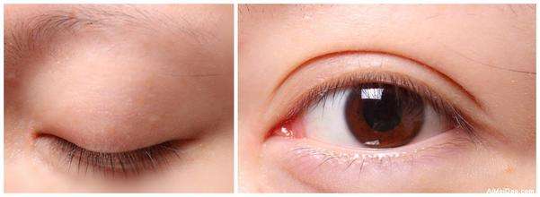 2023昆明隔空溶脂瘦肩部醫(yī)生top10強(qiáng)排名(李明、唐欽、任德浩榜首屬實(shí)意外)