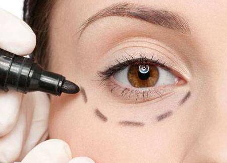 蘇州哪位醫(yī)生修復(fù)雙眼皮失敗靠譜？案例分享有人氣！