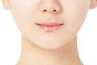 上海第九人民醫(yī)院李圣利：坐診時間、醫(yī)生簡介與雙眼皮案例介紹