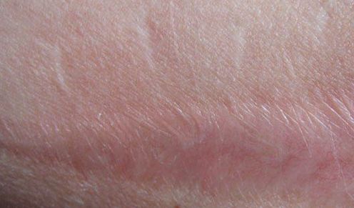 嘉興有哪些專業(yè)的醫(yī)美機(jī)構(gòu)提供雙眼皮手術(shù)？