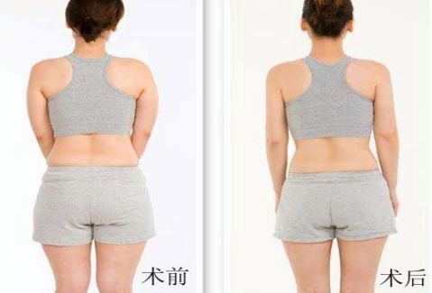 洛陽雙眼皮好的醫(yī)院有哪些？