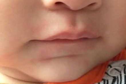 天津星和醫(yī)療美容門診怎么樣？天津星和醫(yī)療美容門診簡介|醫(yī)生團隊|口碑評價！