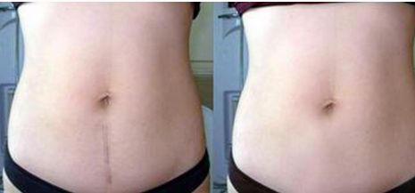 成都眼袋整形醫(yī)院哪家好？選擇專業(yè)整形醫(yī)院護你年輕無眼袋