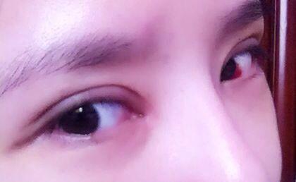 2023北京注射填充豐鼻唇溝正規(guī)醫(yī)生評分前十名(劉艷林、謝永學、李芳品牌醫(yī)美正規(guī)且專業(yè))