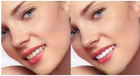 樸正國(guó)正頜手術(shù)有哪些風(fēng)格審美？