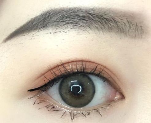 成都哪家美容醫(yī)院的埋線減肥效果好？