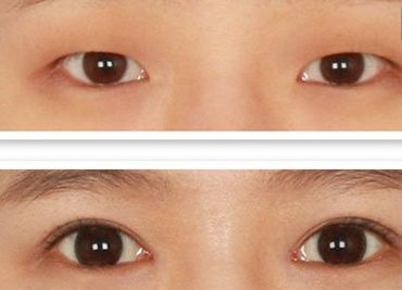 鄭州哪家美容醫(yī)院正規(guī)且口碑好？