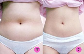 【2023吉林雙眼皮手術(shù)評測】哪家醫(yī)院值得信賴？