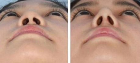 衢州做小手術(shù)哪家醫(yī)院好？快速推薦衢州當(dāng)?shù)貙I(yè)的醫(yī)院